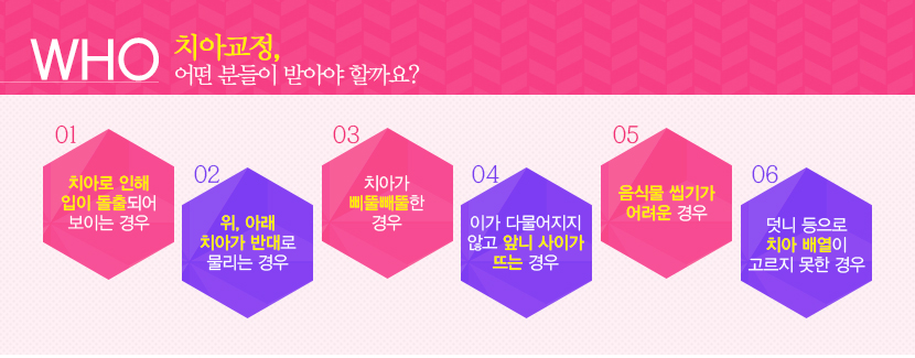 일산 치아교정 대상