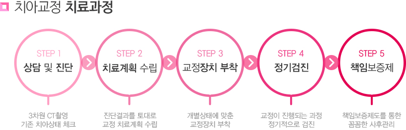 일산 치아교정 치료과정